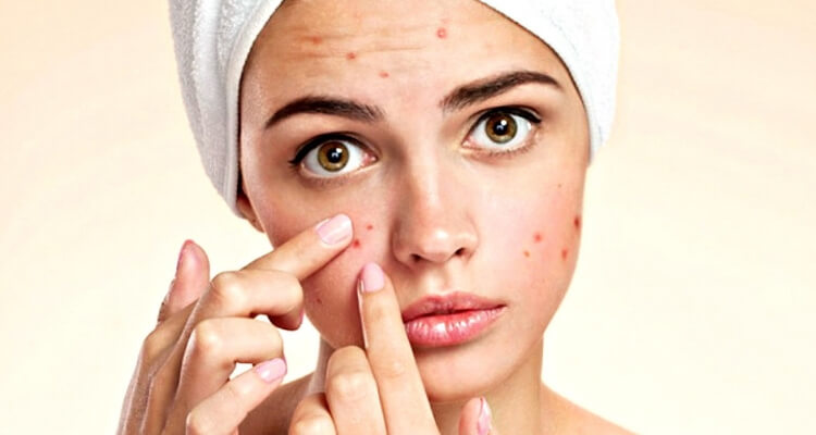 combatte acne